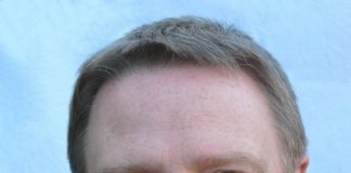 Graumann verstärkt FOR-A Graumann verstärkt FOR-A